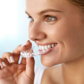 clear aligners